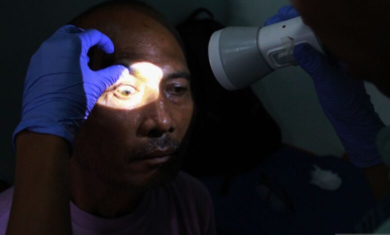 8 penggerak mata belekan juga cara alami mengobatinya